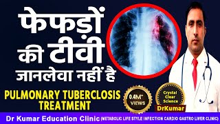 Pulmonary Tuberculosis treatmentफेफड़ों की टीवी जानलेवा नहीं है [upl. by Oleta]