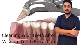 Cleaning Your Teeth After Wisdom Tooth Extraction [upl. by Eittel]