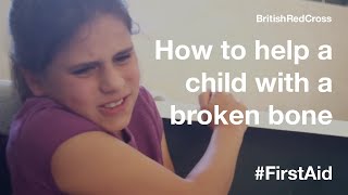 How to help a child with a broken bone FirstAid PowerOfKindness [upl. by Guss]