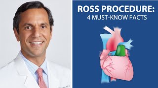 Surgeon QampA 4 MustKnow Facts About The Ross Procedure [upl. by Jarietta486]