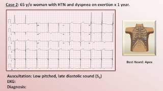 EKG and Heart Murmur Review  Part 1 [upl. by Bronder]