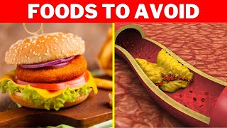 Top 10 Foods That INCREASE Cholesterol You Must Avoid [upl. by Nabala]