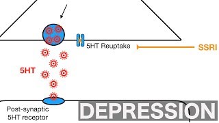 Major Depression and SSRIsSNRIs [upl. by Kenji]