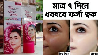 Fair and Lovely ক্রিম টা কতটা উপকারী জেনে নাও [upl. by Sacul]