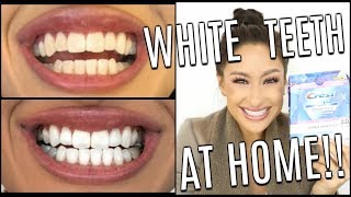 How I Whiten My Teeth At HOME  Does it work Crest 3D White Glamorous White Whitestrips [upl. by Nnaeoj]