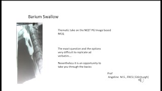 Barium Swallow NEET PG Recall [upl. by Morgan103]