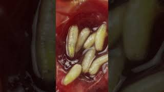 Filth Flies Part 2  How to Get Rid of Fruit Flies Phorid Flies amp Drain Flies [upl. by Ebbarta]