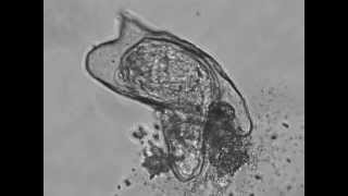 Hatching of a Schistosoma Mansoni Miracidium [upl. by Llenart]