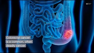 NEK8 regulates colorectal cancer progression by phosphorylating MYC [upl. by Llegna]