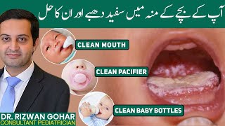 The secret to treating oral thrush 👅in babies oral thrush treatment [upl. by Colyer930]