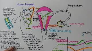 How in vitro fertilization IVF works  Nassim Assefi and Brian A Levine [upl. by Mercie]