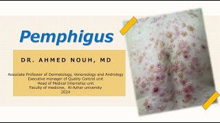 Pemphigus part 1 [upl. by Rosenblatt]