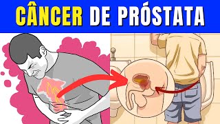 Qual os 10 Sinais do Câncer de Próstata  Tudo o Que Você Precisa Saber [upl. by Noiemad]