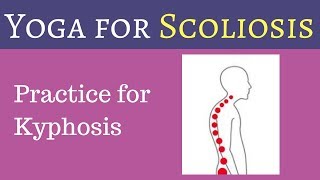 Yoga Exercises for Kyphosis amp Forward Head Posture in Scoliosis [upl. by Irbmac]