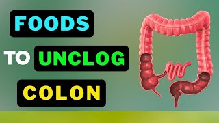 From Clogged to Clean Top Secret Colon Detoxifiers Revealed [upl. by Sidell]