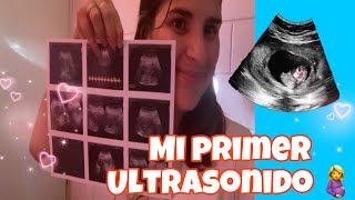 MI PRIMER ULTRASONIDO 🥺🤰 ultrasonido embarazo familia vlog viralvideo [upl. by Ateloiv215]