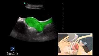 How To Female Pelvis Ultrasound Exam 3D Video [upl. by Gad476]