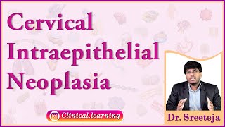 50 Cervical Intraepithelial Neoplasia [upl. by Sokram416]