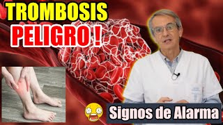 TROMBOSIS 🫁 VENOSA SIGNOS y SINTOMAS 💔 de ALERTA 👉 CONSEJOS 👨‍💼 [upl. by Maryann518]