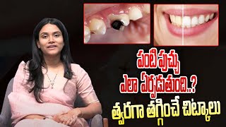 What Causes Tooth Decay  పంటి పుచ్చు ఎలా ఏర్పడుతుందిత్వరగా తగ్గించే చిట్కాలు  TheDoctorTV [upl. by Corley]