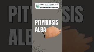 Natural and Alternative Treatment for Pityriasis Alba by IAFA Ayurveda® shorts [upl. by Mort115]