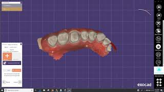 Carestream Design Software Demonstration [upl. by Enitnelav706]