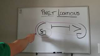 Mnemonic for Locations of Pancreatic Neuroendocrine Tumors PNETs [upl. by Petrie]