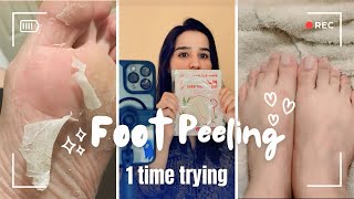 Unbelievable Transformation Testing Foot Peeling Mask [upl. by Sibby994]