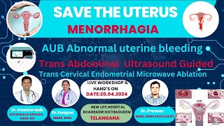 Microwave Endometrial Ablation Workshop [upl. by Leon]