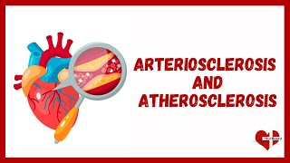 What is Atherosclerosis  Overview of Atherosclerosis and Arteriosclerosis  MedBoard [upl. by Eed]