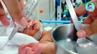 Og Tube feeding  Og Tube Feeding For Newborn  Tube Feeding procedure  NICU viralvideo new cute [upl. by Dwane28]