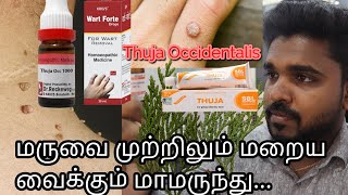 Thuja Best Homeopathic Medicine For Warts amp Skin tag  DrChristant leo [upl. by Anits]