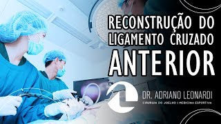 RECONSTRUÇÃO DO LIGAMENTO CRUZADO ANTERIOR  Dr Adriano Leonardi [upl. by Chang]