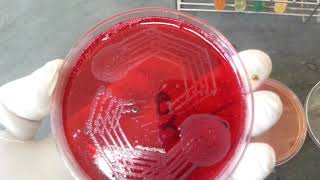 Shigella spp biochemical amp its Growth on various media [upl. by Oilegor663]