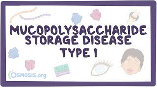 Mucopolysaccharide Storage Disease Type I Hurler HurlerScheie and Scheie syndromes [upl. by Hurlee]