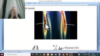 Orthopaedic in Arabic 64 Ewings sarcoma   by DrWahdan [upl. by Idnod]