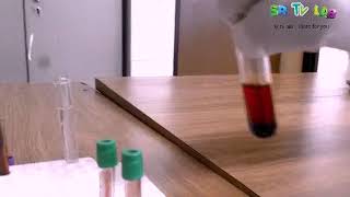 What is hemolysis hemolysis experiment using water [upl. by Neerod]