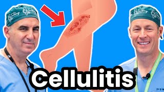 Cellulitis Explained By Infectious Disease Doc Red Sore And Swollen [upl. by Francine]