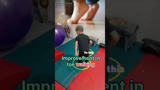 Improving in toe walking toewalking pediatrics [upl. by Ilam]