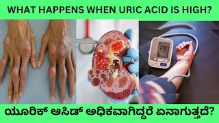 HIGH URIC ACID CAN DAMAGE YOUR HEARTLIVER KIDNEY AND BRAININCREASED SERUM URIC ACID IN KANNADA [upl. by Earesed]