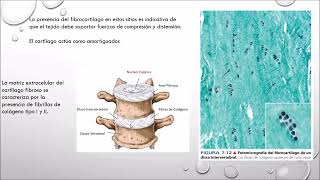 Tejido Cartilaginoso sesión 2 Histología [upl. by Warfield]