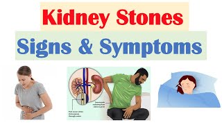 Kidney Stones Nephrolithiasis Signs amp Symptoms  amp Why They Occur [upl. by Aielam]