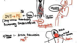 Hematology  AntiCoagulants [upl. by Gut]