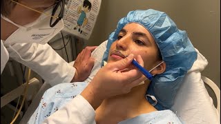 SURGERY  Recreating The Cupids Bow and Central Columns [upl. by Shellie132]