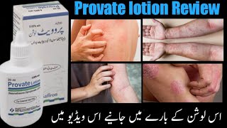 Provate lotion Uses and Side Effects in Urdu Hindi Provate lotion benefits Allergy Treatment [upl. by Iblehs624]