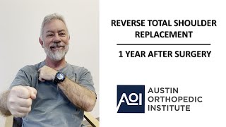 Reverse Total Shoulder Replacement Listen to a patients experience 1 [upl. by Rehsa]