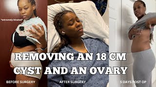 Finding out I HAD ENDOMETRIOSIS AND AN 18CM CYST in my Ovary Right ovary gets removed [upl. by Jermain]