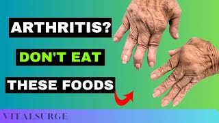 9 Foods To Avoid for Arthritis Stop Now [upl. by Eniamej]