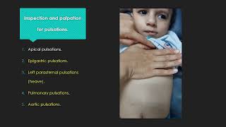 Basic Pediatric Cardiac examination [upl. by Jarus]