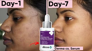 7day Derma Co Serum Challenge You wont believe what happened 😱 [upl. by Hillari]